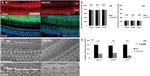 MYO7A Antibody in Immunohistochemistry (IHC)