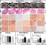 HIF1A Antibody in Immunohistochemistry (IHC)