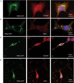 CD2AP Antibody in Immunocytochemistry (ICC/IF)