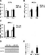 NCEH1 Antibody in Western Blot (WB)