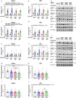 GLUT4 Antibody in Western Blot (WB)