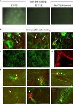 Connexin 26 Antibody in Immunocytochemistry (ICC/IF)