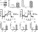 PRKAR2B Antibody in Western Blot (WB)