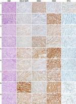 ETV1 Antibody in Immunohistochemistry (IHC)