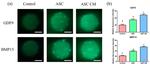 BMP-15 Antibody in Immunocytochemistry (ICC/IF)