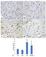 Bcl-2 Antibody in Immunohistochemistry (IHC)