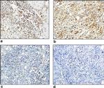 CTLA-4 Antibody in Immunohistochemistry (IHC)