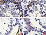 ID4 Antibody in Immunohistochemistry (IHC)