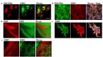 PDGFRA Antibody in Immunocytochemistry (ICC/IF)