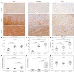 TRPC6 Antibody in Immunohistochemistry (IHC)