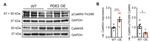 Phospho-CaMKII alpha (Thr286) Antibody in Western Blot (WB)