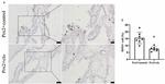 Myeloperoxidase Antibody in Immunohistochemistry (IHC)