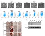 WT1 Antibody in Immunohistochemistry (IHC)