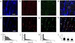 JPH2 Antibody in Immunohistochemistry (Frozen) (IHC (F))