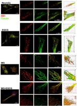 EB1 Antibody in Immunocytochemistry (ICC/IF)