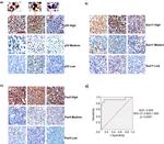 p53 Antibody in Immunohistochemistry (IHC)