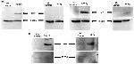 SOCS1 Antibody in Western Blot (WB)