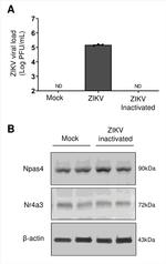 NOR-1 Antibody in Western Blot (WB)