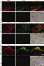 EpCAM Antibody in Immunohistochemistry (IHC)