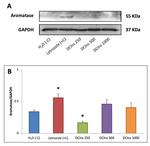 Aromatase Antibody in Western Blot (WB)