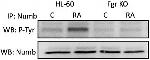 NUMB Antibody in Immunoprecipitation (IP)