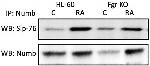 NUMB Antibody in Western Blot, Immunoprecipitation (WB, IP)