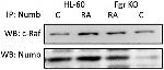 NUMB Antibody in Western Blot, Immunoprecipitation (WB, IP)