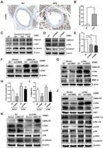 CMKLR1 Antibody in Western Blot (WB)