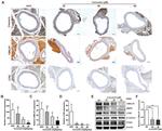 CMKLR1 Antibody in Western Blot, Immunohistochemistry (WB, IHC)