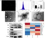 TSG101 Antibody in Western Blot (WB)