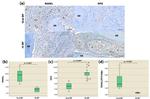 TNFRSF11B Antibody in Immunohistochemistry (IHC)