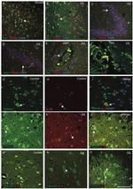 IL-6 Antibody in Immunohistochemistry (IHC)