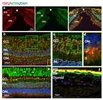 Thrombospondin 1 Antibody in Immunohistochemistry (IHC)