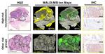 AHNAK Antibody in Immunohistochemistry (IHC)