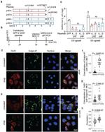 OAS1 Antibody in Immunocytochemistry (ICC/IF)