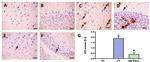 Caspase 3 Antibody in Immunohistochemistry (IHC)