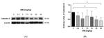 Calbindin D28K Antibody in Western Blot (WB)