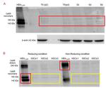 Calcium Sensing Receptor Antibody in Western Blot (WB)