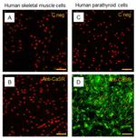 Calcium Sensing Receptor Antibody in Immunocytochemistry (ICC/IF)