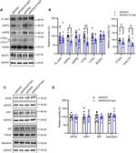 beta Amyloid Antibody in Western Blot (WB)