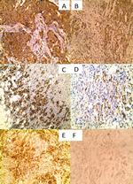 VDR Antibody in Immunohistochemistry (IHC)