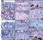 CD34 Antibody in Immunohistochemistry (IHC)