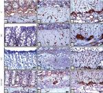 Vimentin Antibody in Immunohistochemistry (IHC)