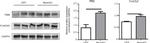 CK2 alpha-2 Antibody in Western Blot (WB)