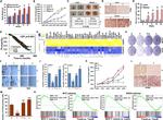 PCNA Antibody in Immunohistochemistry (IHC)