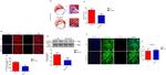 Cardiac Troponin T Antibody in Immunohistochemistry (IHC)