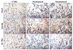 CD127 Antibody in Immunohistochemistry (IHC)