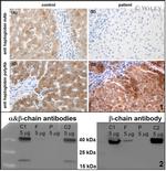 Haptoglobin Antibody in Western Blot (WB)