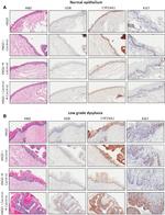 VDR Antibody in Immunohistochemistry, Immunohistochemistry (Paraffin) (IHC, IHC (P))