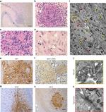 Cytokeratin 18 Antibody in Immunohistochemistry (IHC)